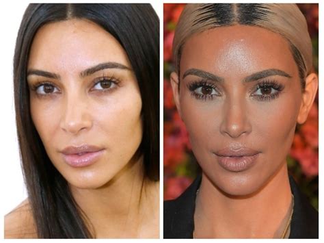 Kim Kardashian Before And After: Plastic Surgery Timeline