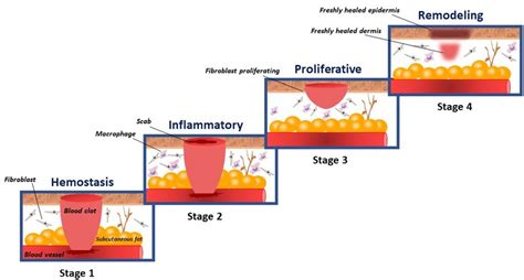 Different stages of the wound-healing process. | Download Scientific Diagram