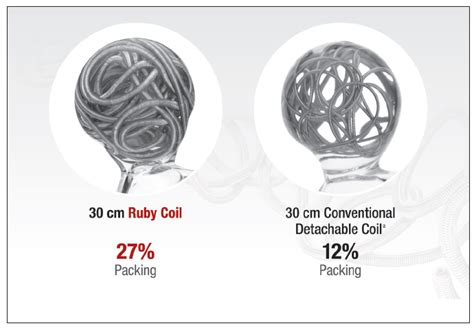 What Are Embolization Coils Made Of - mapasgmaes