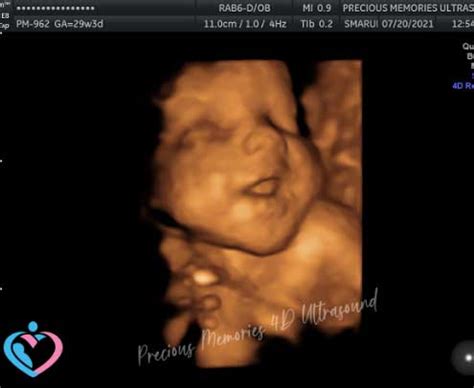 3D Pregnancy Ultrasounds Atascocita TX | 3D Pregnancy Ultrasounds Humble TX