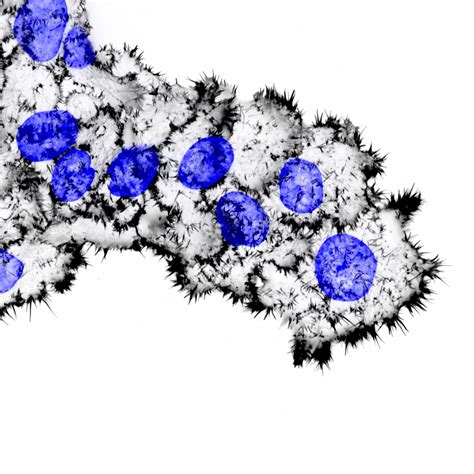 Gallery – CELL MIGRATION LAB