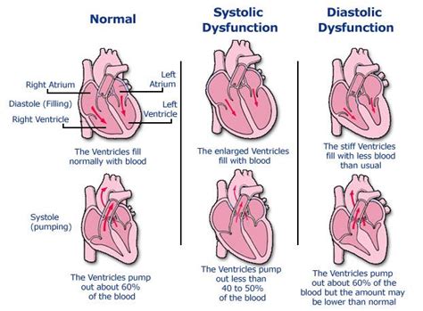 Pathology And Clinical Manifestation/Symptomatology Of Heart Failure