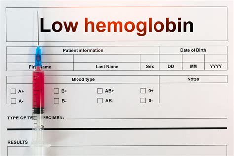 Can cirrhosis cause low hematocrit and hemoglobin - ghdelta