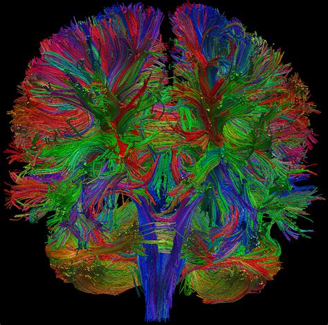 Diffusion Tensor Imaging (DTI) of human brain : woahdude