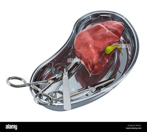 Liver transplant surgery concept. Donor liver in metallic tray with ...