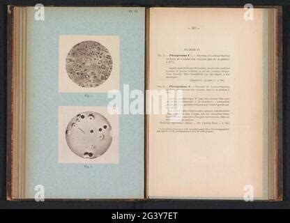 Two microscope shots of cholera Stock Photo - Alamy