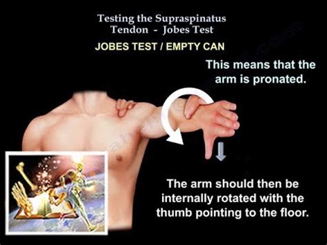 Testing the Supraspinatus muscle , Jobes Test - Everything You Need To ...