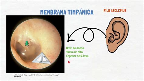 Membrana timpánica - Anatomía y exploración. - YouTube