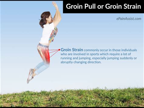 Groin Pull or Groin Strain|Symptoms|Treatment|Recovery|Prognosis|Prevention