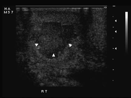 Ultrasound of the acute scrotum • APPLIED RADIOLOGY