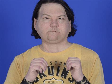 'So Happy:' World's First Hand/Face Transplant Patient Doing Well | CRMC Outpatient Pharmacy ...