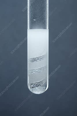 Magnesium reacts with hydrochloric acid - Stock Image - C028/0733 - Science Photo Library