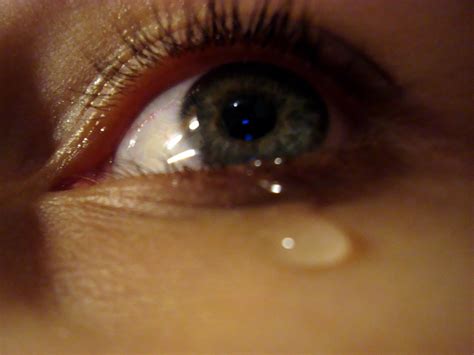 Teary Eyes: When Is It Time To See A Doctor - Palm Springs Eyelid Surgery