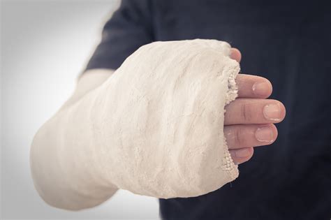 Plaster of Paris – Once a Backbone of Orthopaedics - Bonesurgeon