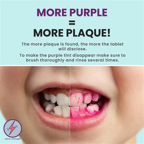 Plaque Disclosing Tablets for Teeth, 96 Count, Dental Disclosing ...