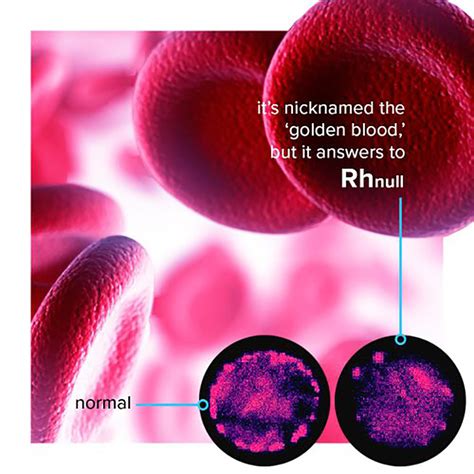 Rhnull is the World's Rarest Blood Type and Nicknamed "Golden Blood", Here's Why - TechEBlog