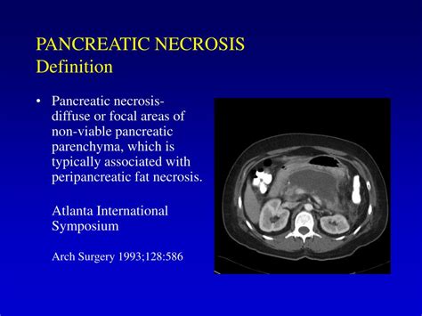 PPT - MANAGEMENT OF PANCREATIC NECROSIS PowerPoint Presentation, free download - ID:83671