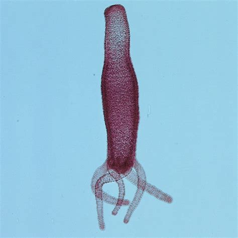 Hydra (Cnidarians) Microscope Slides | Carolina.com