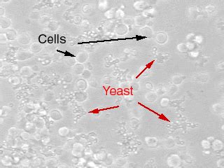 Yeast - UNC Lineberger