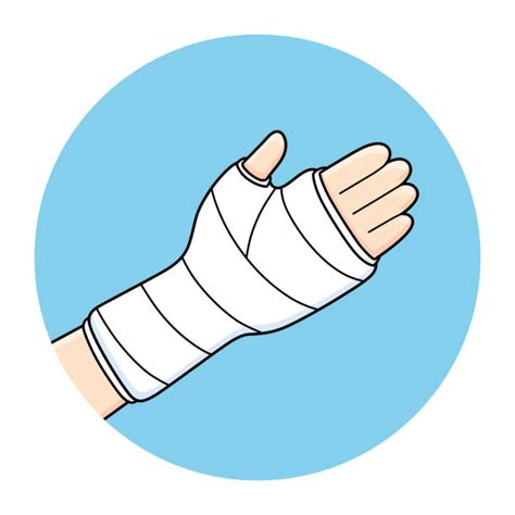 Cartoon Of Broken Arm Cast Illustrations, Royalty-Free Vector Graphics & Clip Art - iStock