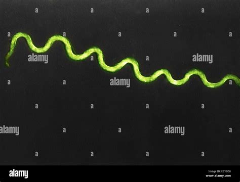 Treponema pallidum shown under dark field light microscopy Stock Photo ...