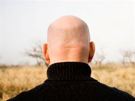 The bald truth: How author Nick Coleman's thinning hair made him heir to a thousand sorrows ...