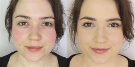 How to Cover Up Rosacea - Makeup Tutorial for Concealing Redness