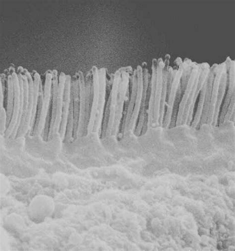 Advanced Molecular Diagnostics for Microvillus Inclusion Dis | Cell And Molecular Biology