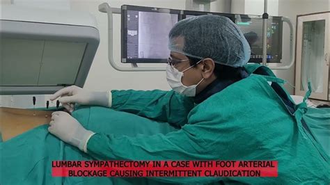 Lumbar sympathectomy in a case with foot arterial blockage causing intermittent claudication ...