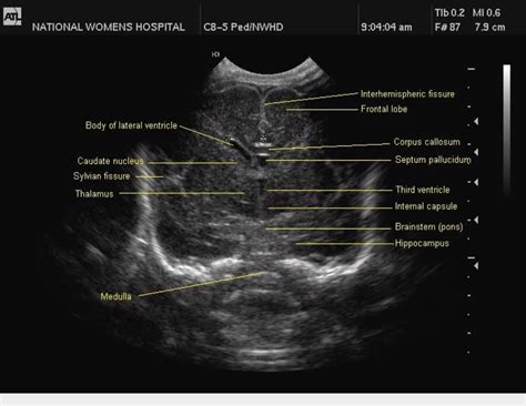 Ultrasound School, Ultrasound Physics, Ultrasound Sonography, Baby ...