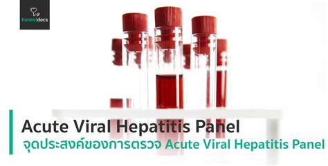 Acute Viral Hepatitis Panel | HD สุขภาพดี เริ่มต้นที่นี่