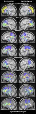 Frontiers | Blue-Light Therapy following Mild Traumatic Brain Injury: Effects on White Matter ...