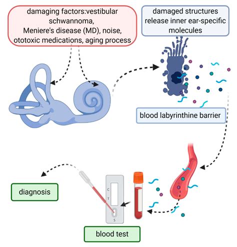 Diagnostics | Free Full-Text | Biomarkers for Inner Ear Disorders ...