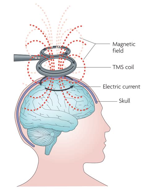 Transcranial magnetic stimulation - HCE Wiki - The Human Cognitive ...