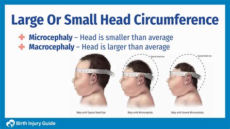 Large or Small Head Circumference - Birth Injury Guide