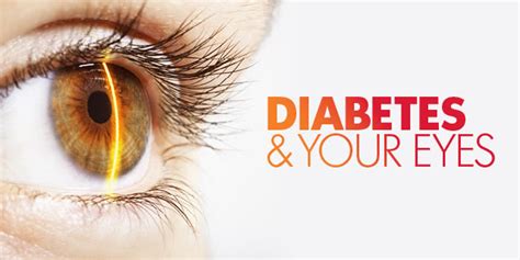 Your Eyes & Diabetes | Select Eyecare | MN