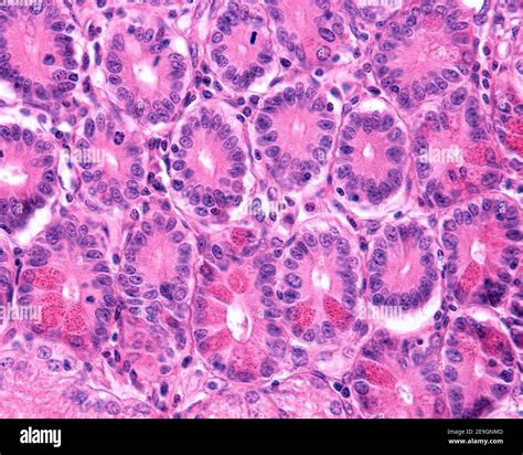 Paneth cells showing very eosinophilic granulations. They are located ...