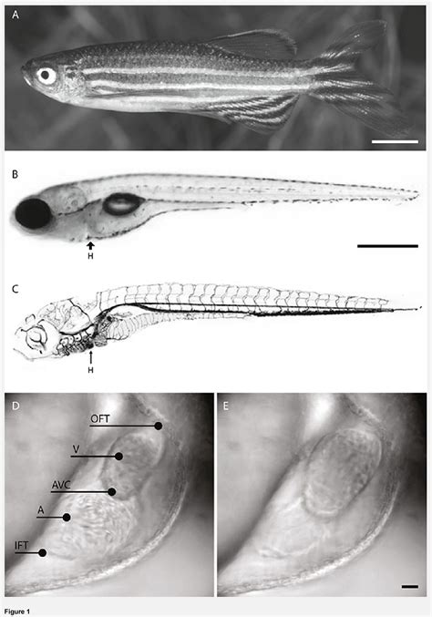 Figure 1 from In vivo imaging of cardiac development and function in zebrafish using light sheet ...