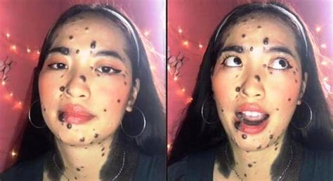 Viral Banyak Tahi Lalat Di Wajah, Wanita Ini Dipuji Tetap Cantik - Smart News Tapanuli