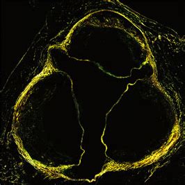 Heart Histology - Aortic Sinus - histology slide