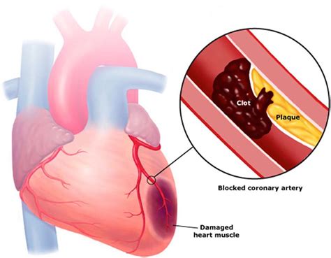 8 Early Warning Signs Of A Blood Clot You Should Never Ignore - Small Joys