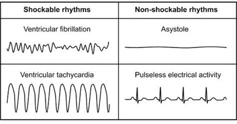 Understanding Shockable vs. Non-Shockable Heart Rhythms