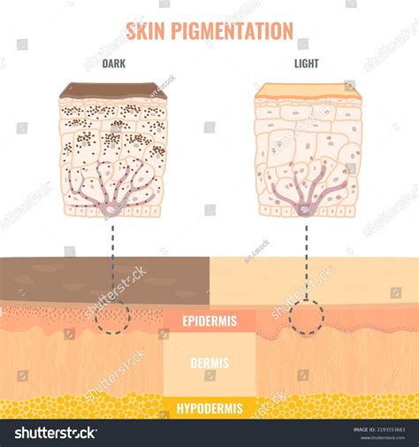 Comparison Melanosomes Distribution Dark Light Skin Stock Vector ...