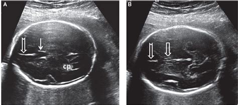 Normal Fetal Ultrasound Survey | Radiology Key