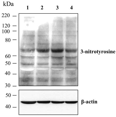 Peroxynitrite formation in retinal pericytes exposed to oxidized-LDL... | Download Scientific ...