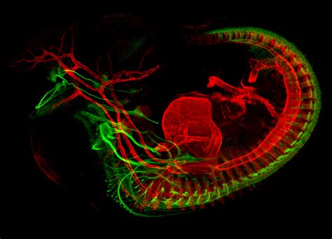 Dr Mary Whitman - From Nerve Development to Vision: A Bumpy Ride ...