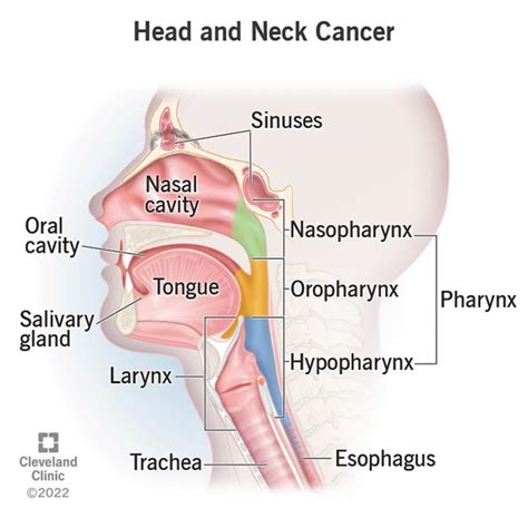 Head and Neck Cancers: Symptoms & Treatment