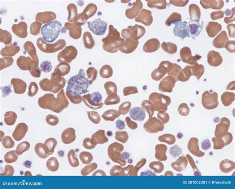 Giant Platelets in Peripheral Blood. Stock Image - Image of ...