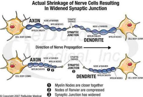 Alcoholic Neuropathy Symptoms – Raging Alcoholic