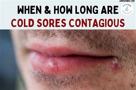 When & How Long Are Cold Sores Contagious, and Its Spread